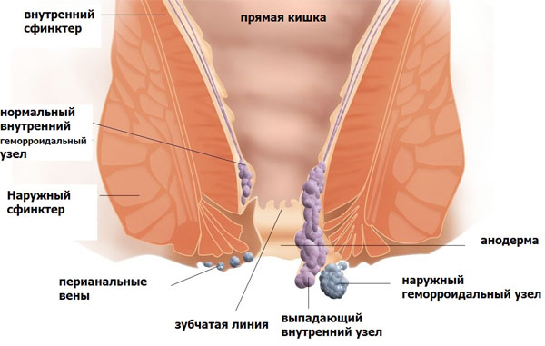 лечение геморроя Обнинск